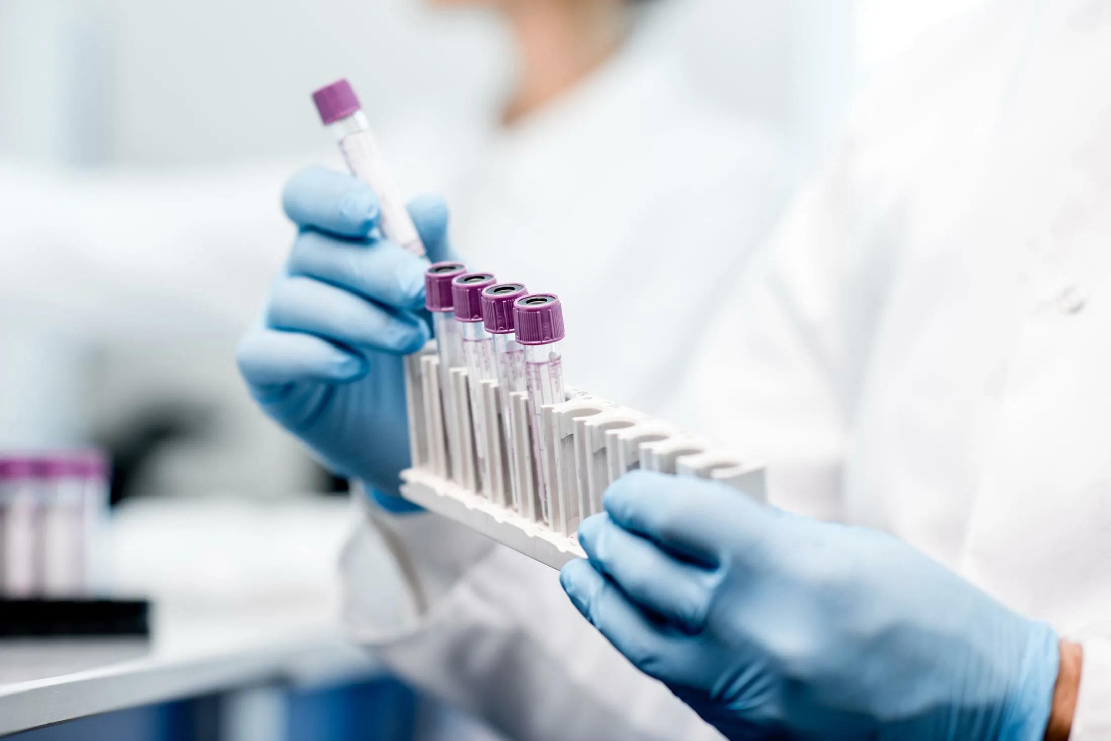 Where is the line between self-care and media pressure?